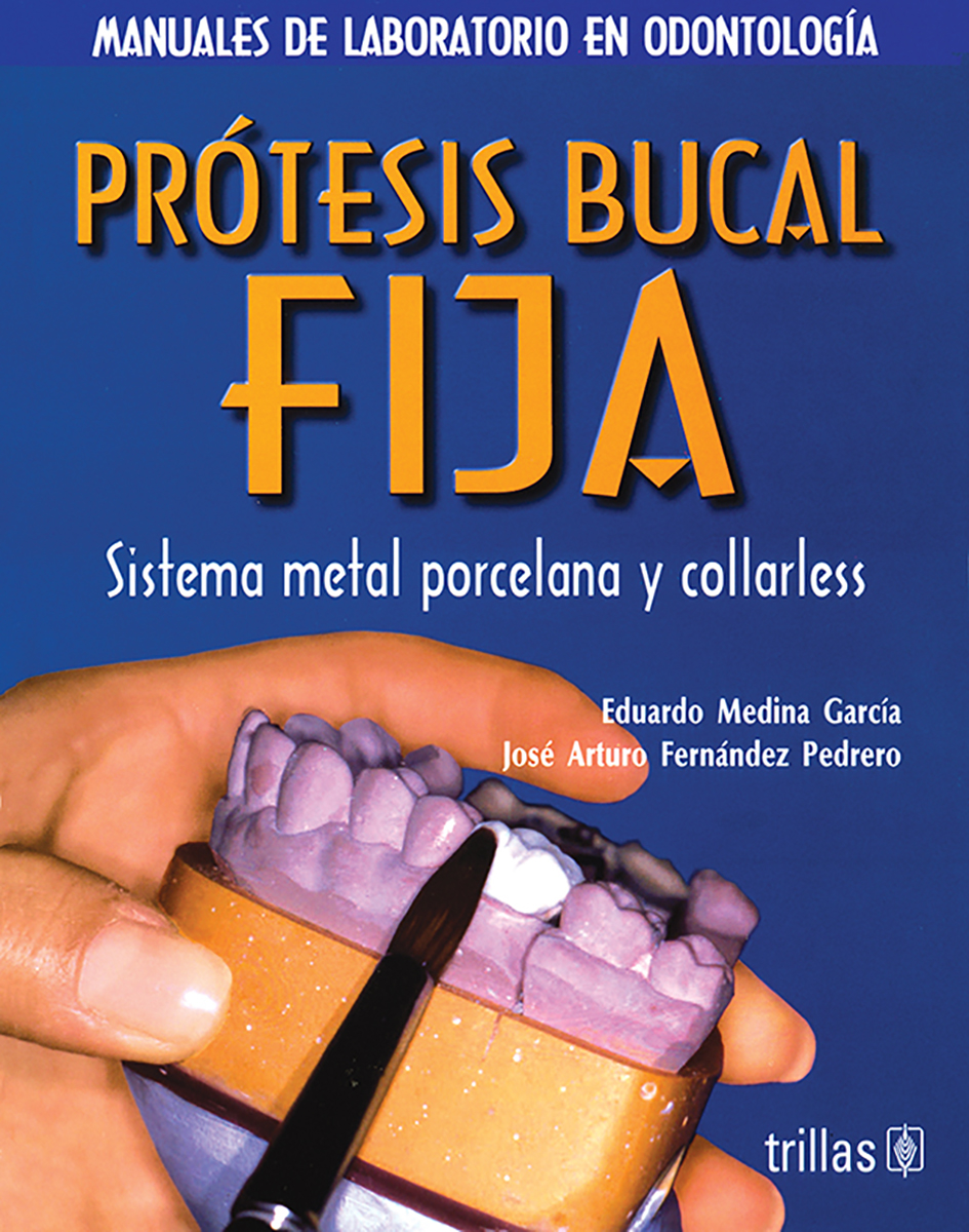 Prótesis bucal fija