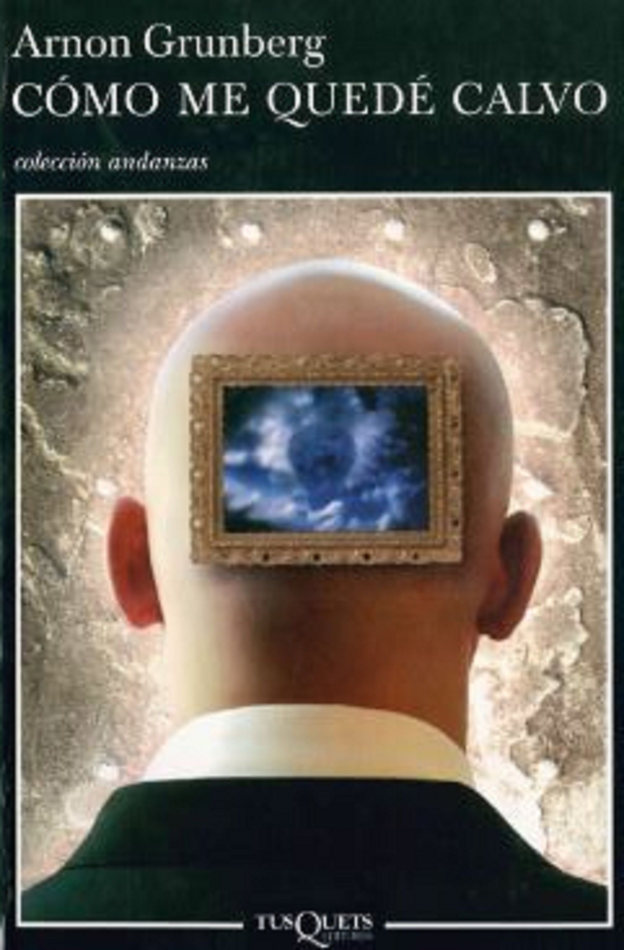 Cómo me quedé calvo