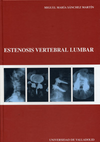 ESTENOSIS VERTEBRAL LUMBAR