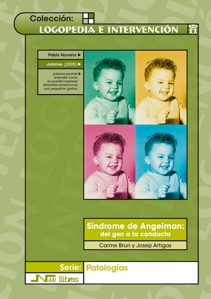 Síndrome de Angelman: del gen a la conducta