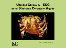 Utilidad Clínica del ECG en el Síndrome Coronario Agudo