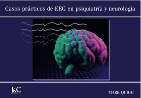 Casos prácticos de EEG en psiquiatría y neurología