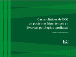 Casos clínicos de ECG en pacientes hipertensos en diversas patologías cardiacas