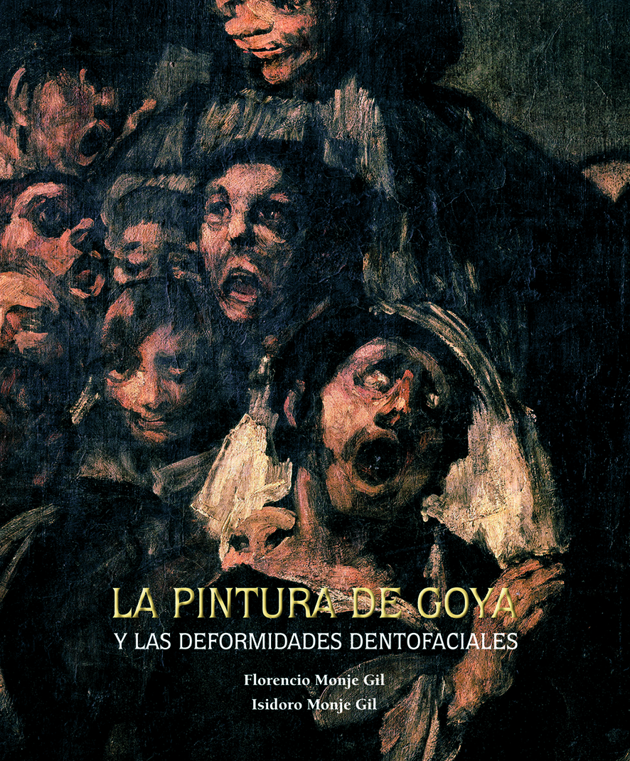 La pintura de Goya y las deformidades dentofaciales