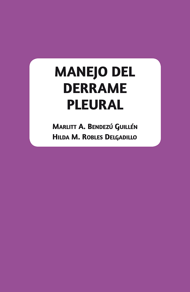 Manejo del derrame pleural