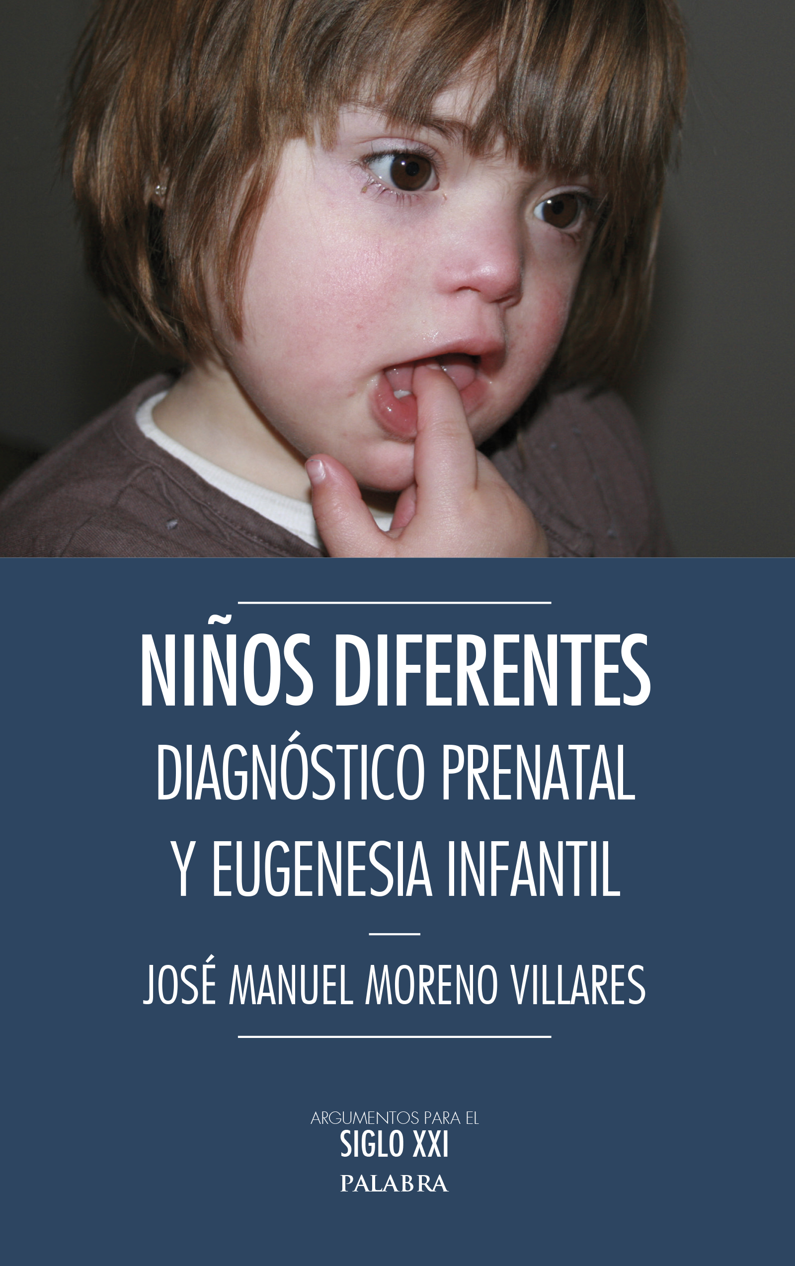 Niños diferentes