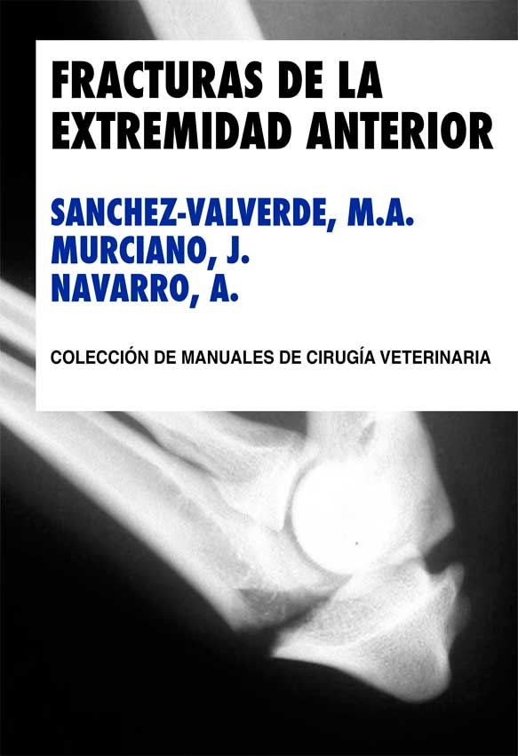 FRACTURAS DE LA EXTREMIDAD ANTERIOR