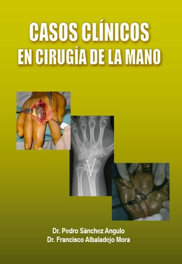 CASOS CLINICOS EN CIRUGIA DE LA MANO