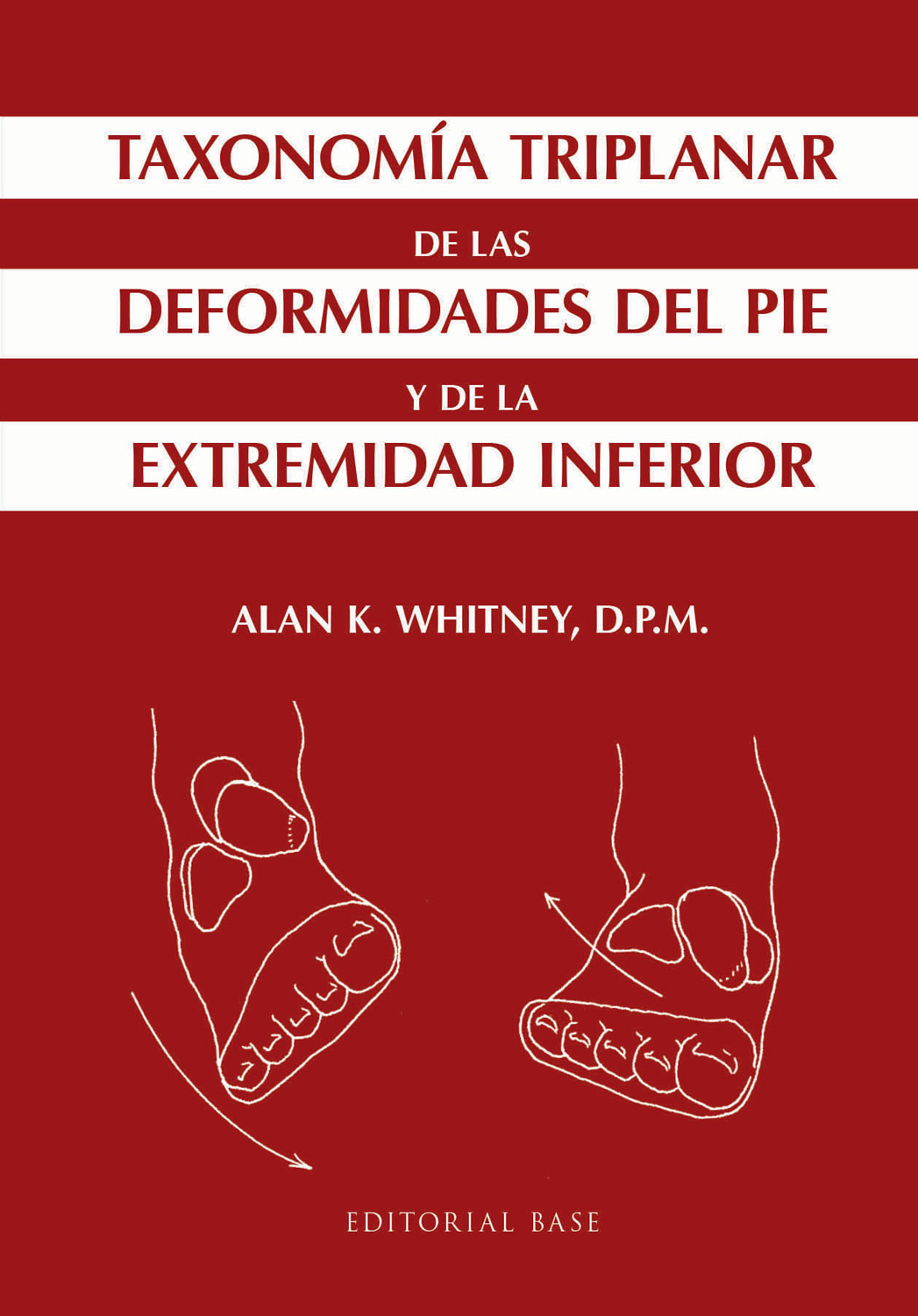 Taxonomía triplanar de las deformidades del pie y de la extremidad inferior