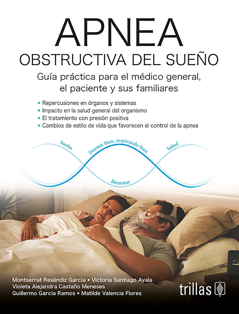 Apnea obstructiva del sueño