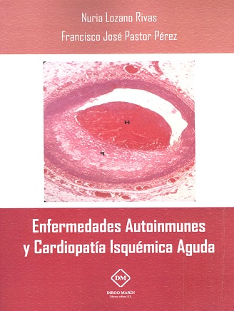 ENFERMEDADES AUTOINMUNES Y CARDIOPATIA ISQUEMICA AGUDA