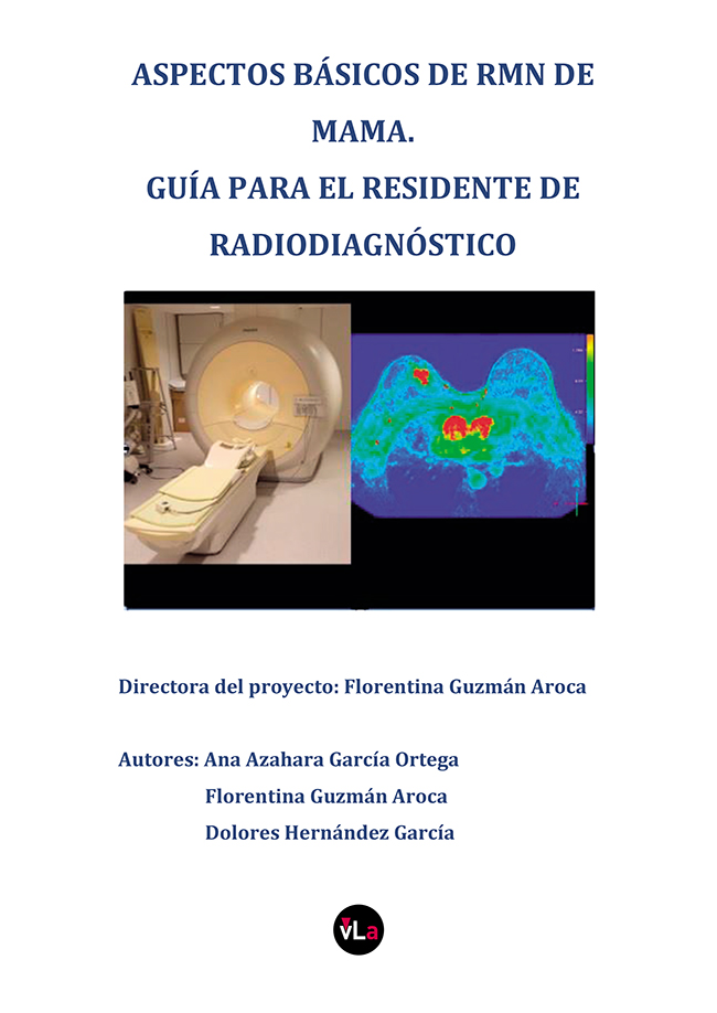 Aspectos básicos de rmn de mama.