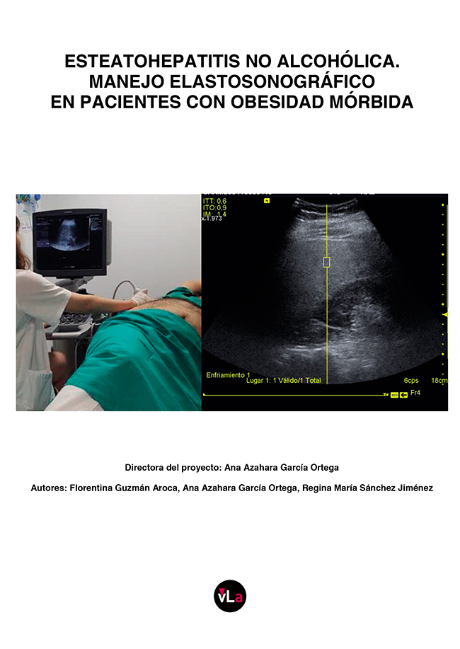 Esteatohepatitis no alcohólica