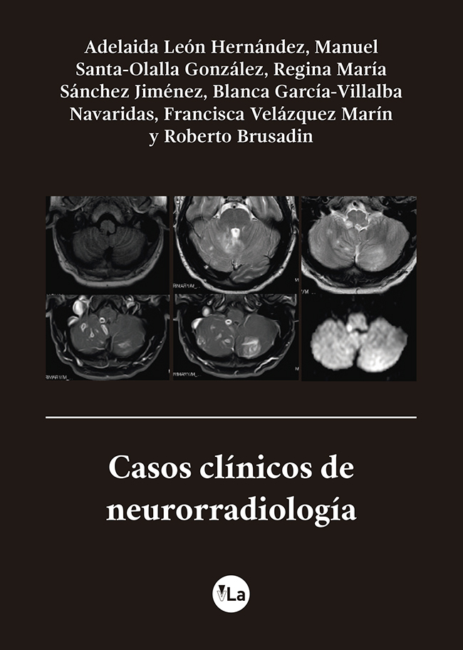 Casos clínicos de neurorradiología