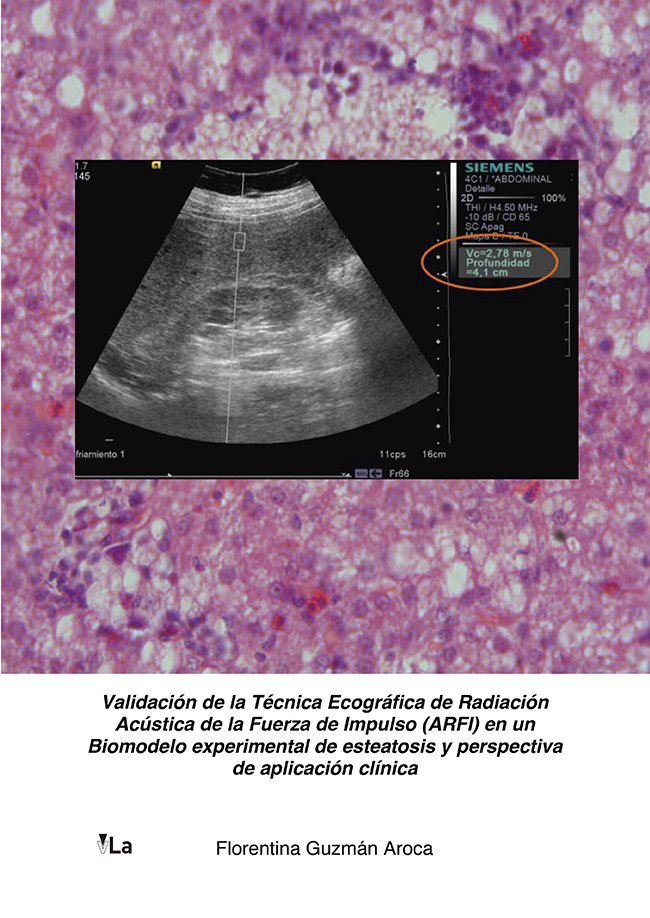 Validación de la técnica ecográfica de radiación acústica de la fuerza de impulso (ARFI) en un biomodelo experimental de esteatosis y perspectiva de aplicación clínica