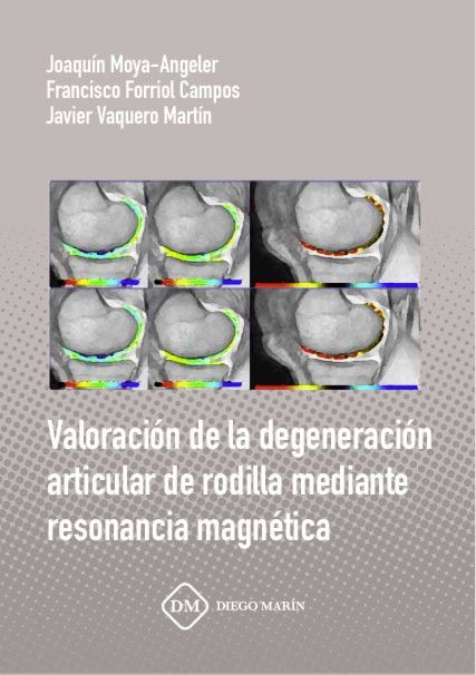 VALORACION DE LA DEGENERACION ARTICULAR DE RODILLA MEDIANTE RESONANCIA MAGNETICA