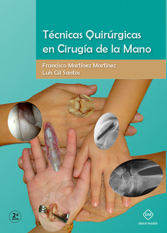 TECNICAS QUIRURGICAS EN CIRUGIA DE LA MANO