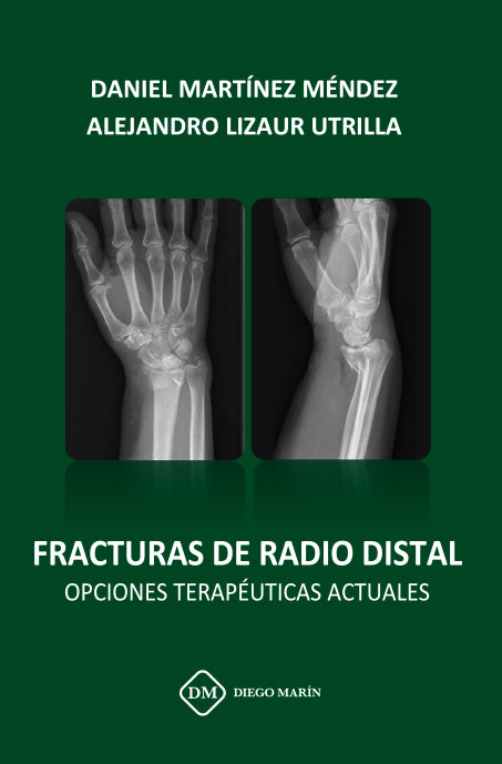 FRACTURAS DE RADIO DISTAL OPCIONES TERAPEUTICAS ACTUALES