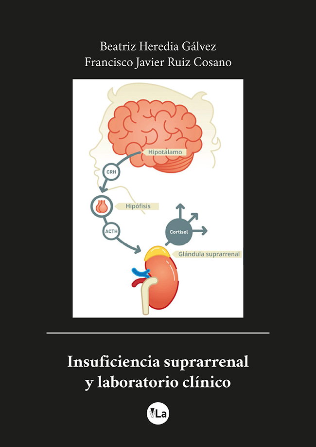 Insuficiencia suprarrenal y laboratorio clínico