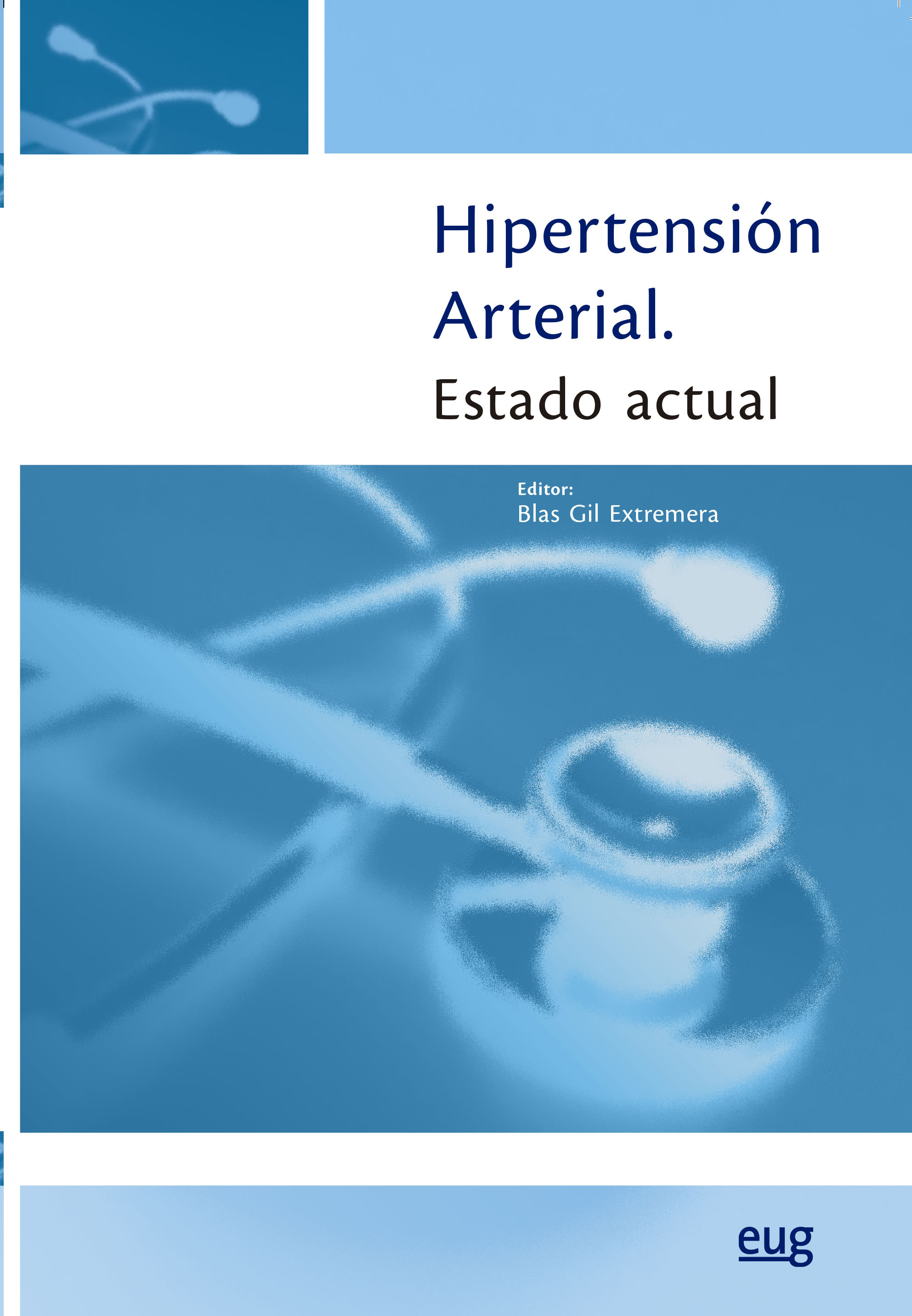 Hipertensión arterial