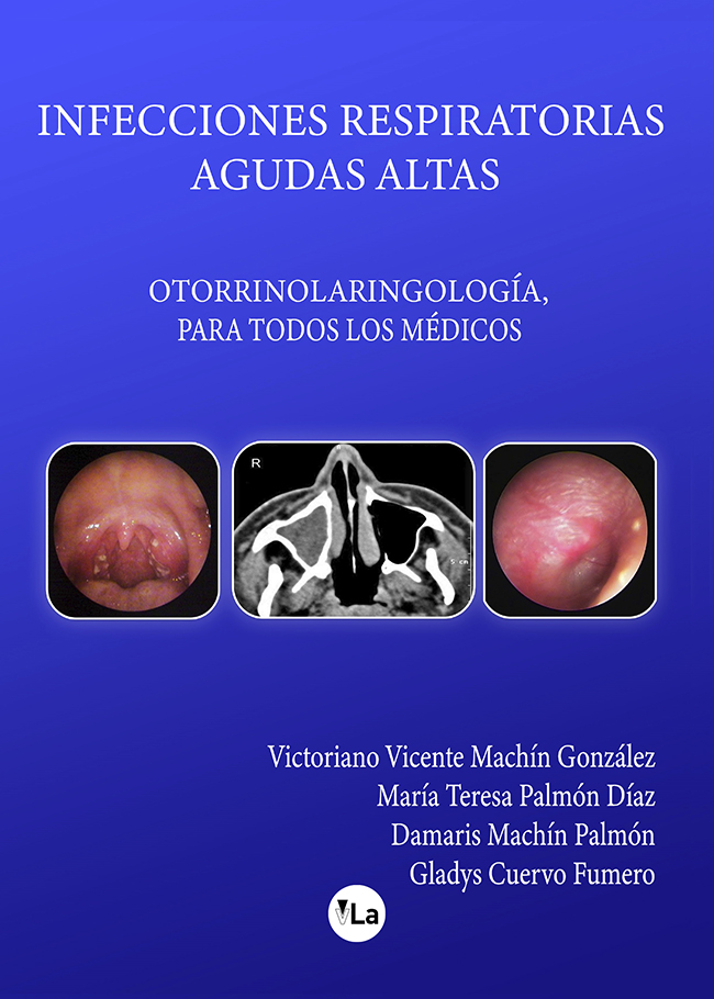 Infecciones respiratorias agudas altas