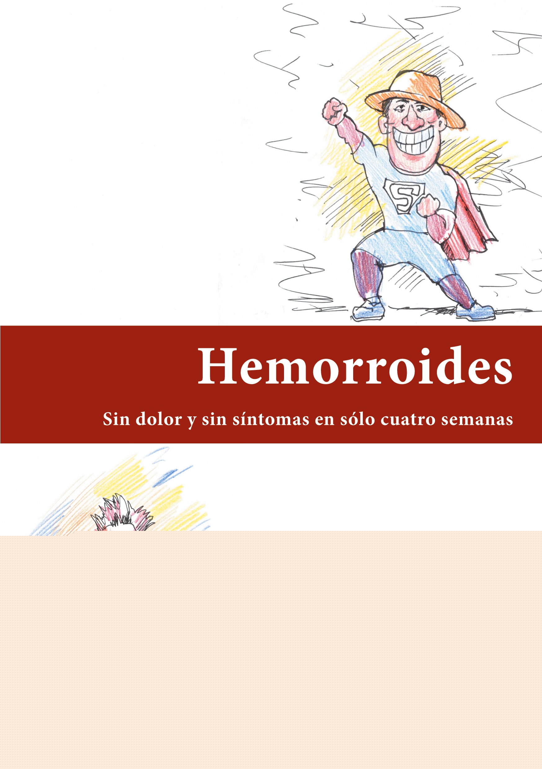 Hemorroides