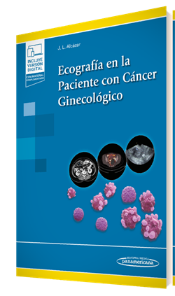 Ecografía en la Paciente con Cáncer Ginecológico