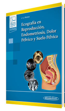 Ecografía en Reproducción, Endometriosis, Dolor Pélvico y Suelo Pélvico