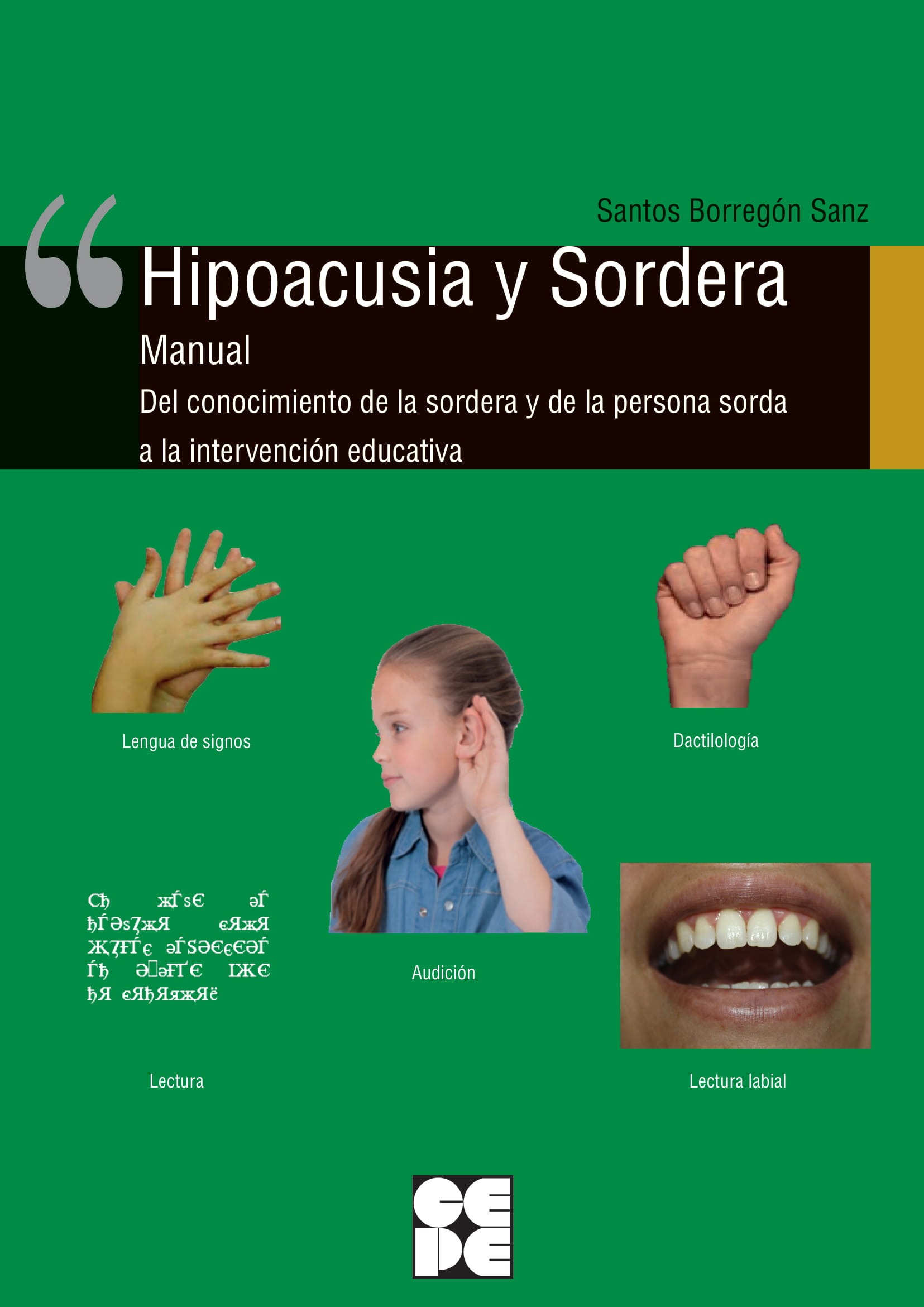 Hipoacusia y Sordera. Manual. del conocimiento de la sordera y de la persona sorda a la intervención educativa