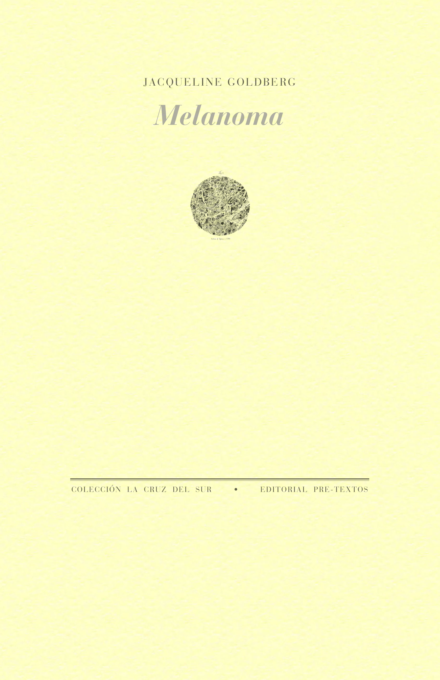 Melanoma